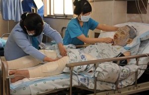 ▲ 9일 밤 발생한 화왕산 억새 태우기 참사로 중화상을 입은 한 시민이 대구 푸른병원에서 긴급 치료를 받고 있다. 사진 작가인 이 시민은 동료를 구하려다 참변을 당했다. 김태형기자 thkim21@msnet.co.kr