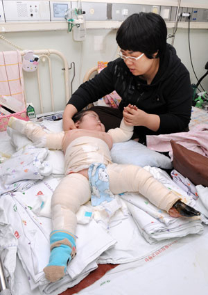 에반스 증후군과 골수 섬유증을 앓고 있는 조혜인 양.