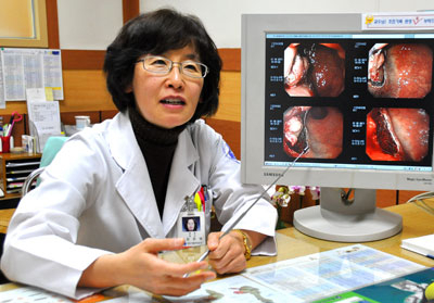 대구가톨릭대병원 소화기내과 김은영 교수는 초음파 내시경을 통해 조기암을 정확하게 진단해낸다.