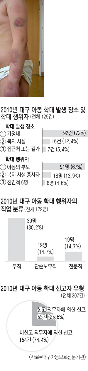 대구의 한 아동보호전문기관에서 보호받고 있는 김모(8) 군은 엄마에게 맞고 물려 온몸이 상처투성이다. 대구아동보호전문기관 제공