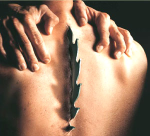 ▲암성 통증이 얼마나 극심한 지를 보여주는 한 제약회사의 이미지 사진.