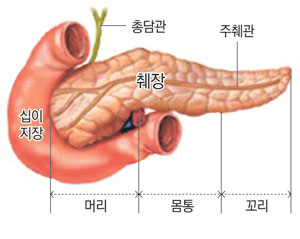 CT로 볼 때 췌장 중 십이지장과 연결되는 몸통 쪽에 췌관이 좁아지는 약간의 협착이 나타나고 있다.