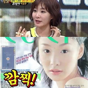 박효주 희귀병 고백 