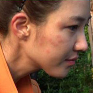 이수경 모기떼 습격 
