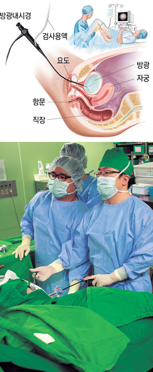 방광암은 초기에 발견하면 비교적 간단한 수술로 완치되고 일상생활에도 지장이 없다. 하지만 늦으면 방광과 주변 장기를 모두 잘라내야 하는 큰 수술이 필요하고 생활에도 큰 불편을 겪는다.