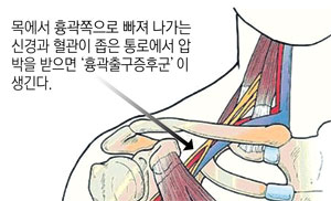 흉곽출구증후근은 한방으로 비교적 잘 치료된다. 이현종 교수가 환자를 진료하고 있다.