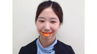 웃음교정기 등을 이용하면 밝은 미소를 찾을 수 있다.