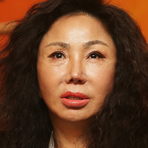 김추자 소주병 테러사건 사진. 연합뉴스