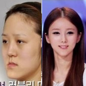 사진. 