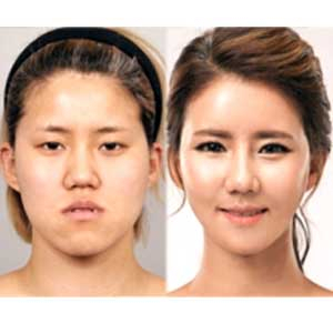 사진. 윤단비(스토리온 렛미인4)