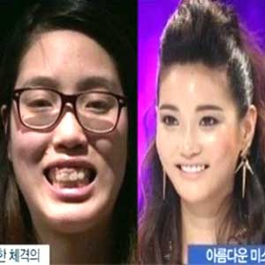 사진. 렛미인 박동희(스토리인 렛미인4 방송 캡처)