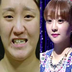 사진. 의부증 아내 김진(스토리온 렛미인 방송 캡처)