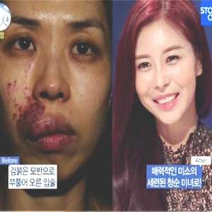 김희은 사진. 스토리온 렛미인4 방송 캡처