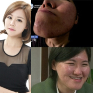 이미지 출처: 케이블TV 스토리온 렛미인4