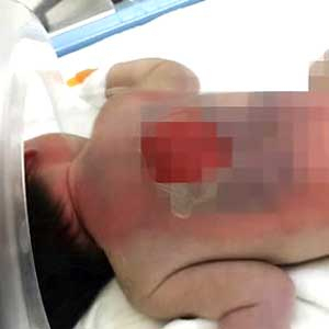 안동 산부인과 화상 사진. 연합뉴스