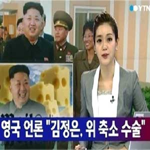 김정은 위 축소 수술 사진. YTN 뉴스캡처