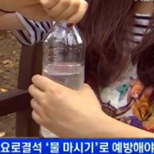 요로결석 원인 사진. MBN 뉴스캡처