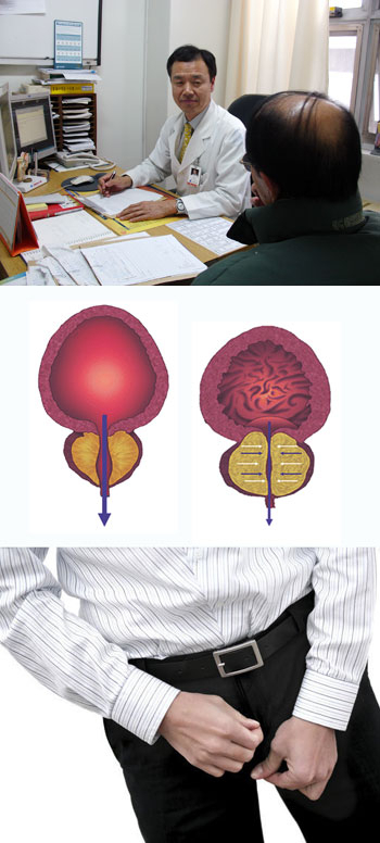 대구가톨릭대병원 비뇨기과 박재신 교수. 소변의 냄새는 임상학적으로 의미가 없지만 소변에 적혈구가 섞여 나오는 혈뇨나 고름이 섞이는 농뇨는 비뇨기계통의 질환을 의심할 수 있다.