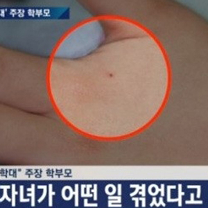 남양주 어린이집 이번엔 바늘 학대 방송캡처