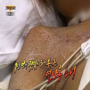 사진, SBS 