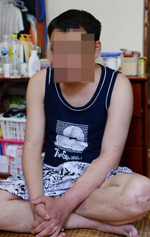 당뇨합병증을 앓고 있는 자신뿐 아니라 파킨슨병에 걸린 어머니와 지체장애 여동생의 치료비까지 책임져야 하는 전경호 씨는 앞으로 어떻게 살아야 할지 눈앞이 캄캄하다. 김영진 기자 kyjmaeil@msnet.co.kr