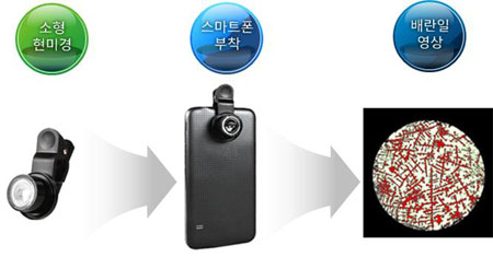 스마트 배란측정기는 스마트폰에 부착한 소형 현미경과 앱으로 타액을 검사해 배란일을 측정하는 모바일 헬스 기기다. 대구시 제공.