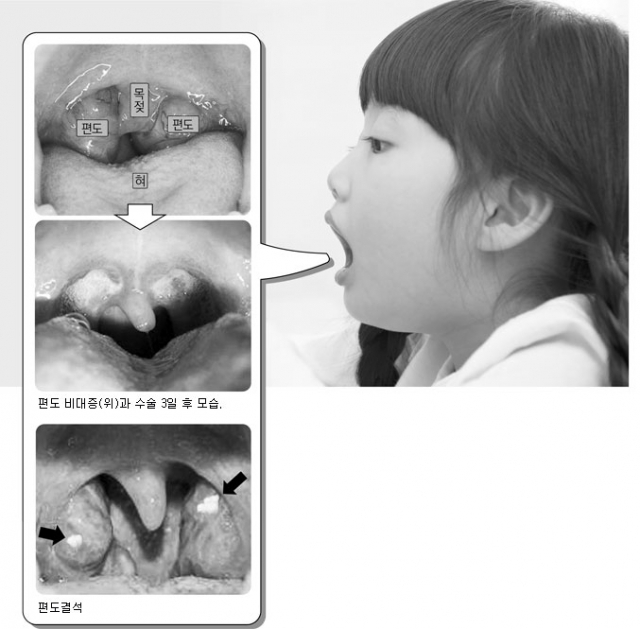 진료 중인 허성재 칠곡경북대병원 이비인후센터 교수. 칠곡경북대병원 제공
