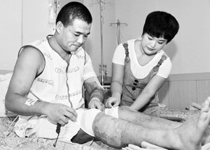 한국에서 대학을 졸업하고 일자리를 구하다 화상을 입은 중국인 유학생 유정신(가명) 씨.