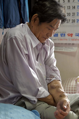 젊은 시절 사고로 하반신이 마비되고 신장마저 나빠져 투석을 받고 있는 정수환(59) 씨.