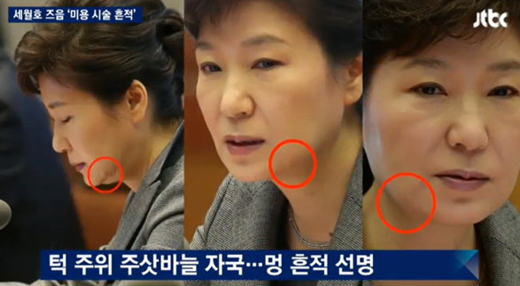 주사아줌마, 기치료아줌마, 박근혜, 정호성, 불법시술, 야매시술 / 사진출처 - JTBC 뉴스룸 제공