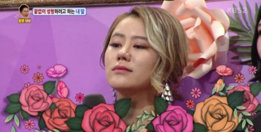 안녕하세요, 성형중독녀 / 사진출처 - KBS 2TV 