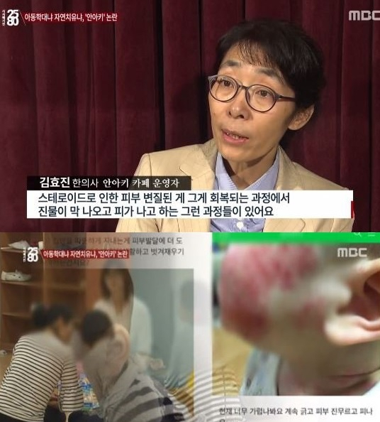 사진=MBC 시사매거진2580