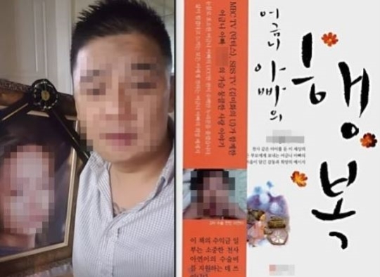 어금니아빠 뜻, 거대백악종 / 사진출처 - 온라인커뮤니티