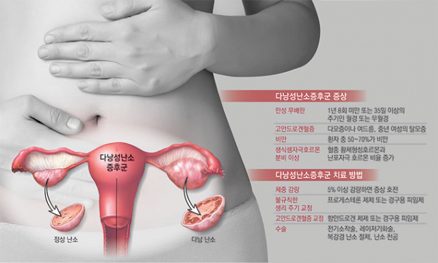 김미주 경북대병원 산부인과 교수
