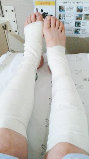 목줄을 하지 않은 개에 물려 크게 다친 양모 씨. [피해자 양모씨 가족 제공=연합뉴스]