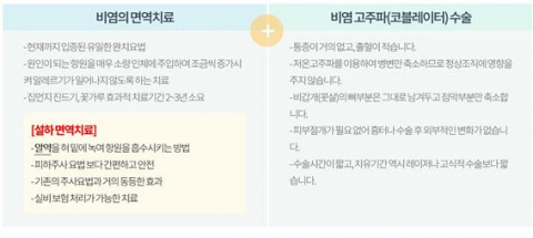 알레르기 비염 치료
