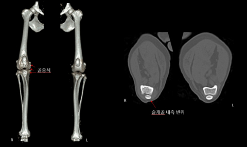 콩이 CT영상 퇴행성골질환 (자료제공: 탑스동물베디컬센터)