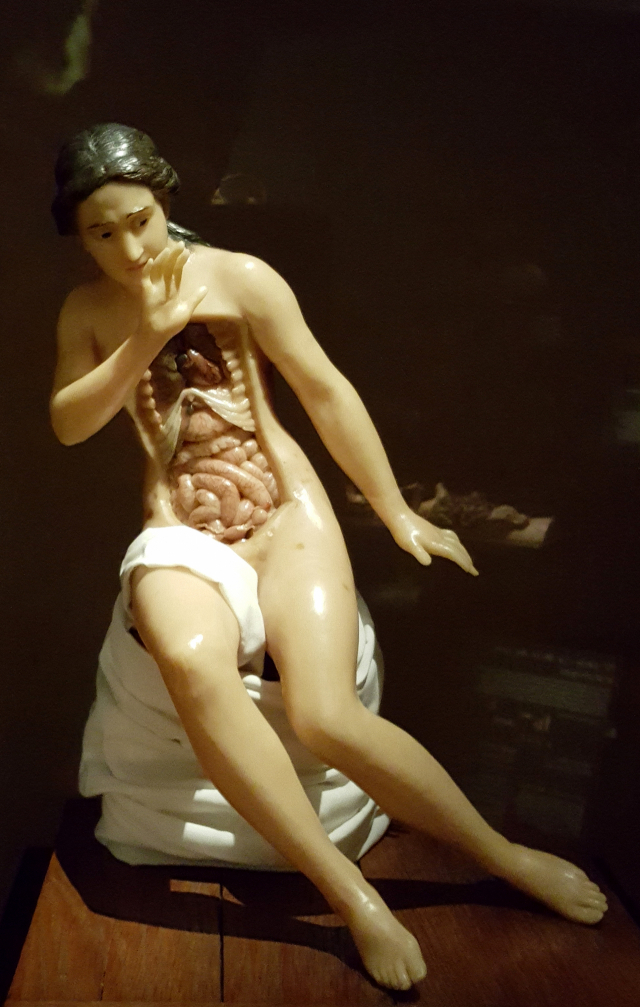 몸속 세균들.왼쪽부터 충치를 생기게하는 뮤탄스균,위염과 위궤양을 일으키는 위궤양균,여드름을 생기게하는 프로피오니박테리움 에크이.