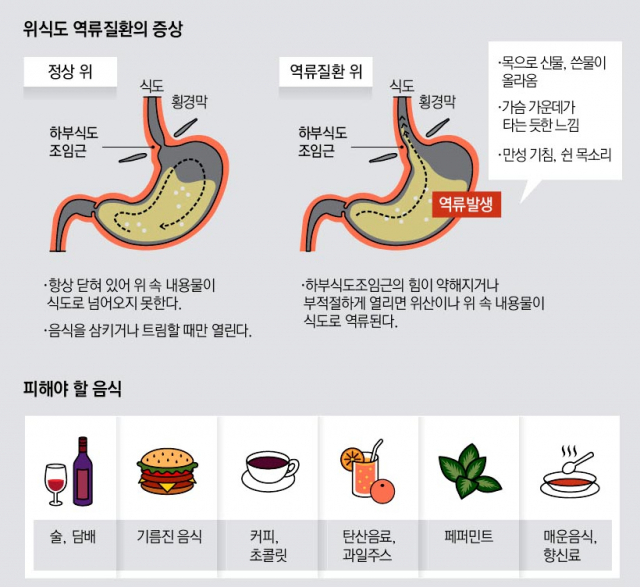 피해야 할 음식