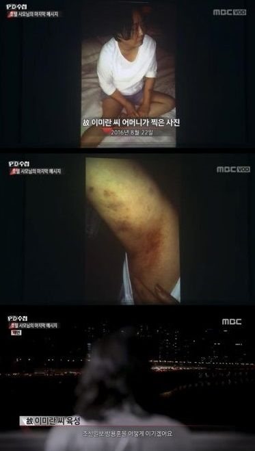 MBC 