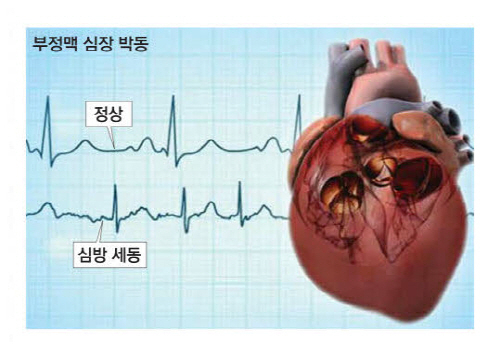 신동구 영남대병원 순환기내과 교수