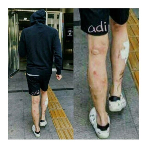 온라인에서 회자되고 있는 박유천 다리 사진. 온라인 커뮤니티 캡쳐