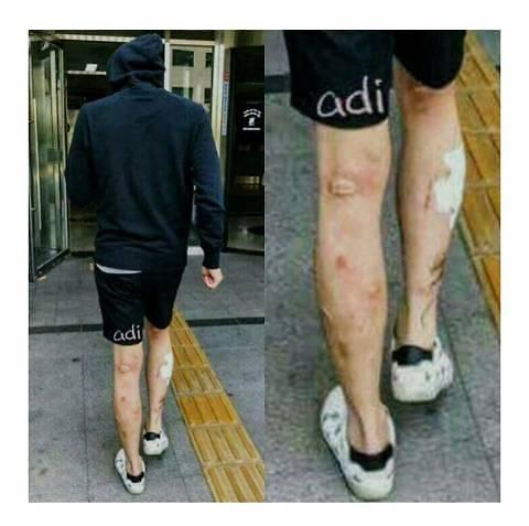 출처: 온라인 커뮤니티