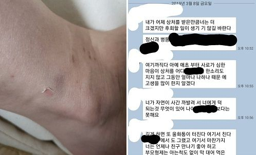 출처: 윤지오 인스타그램