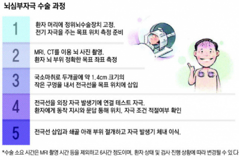 유호성 경북대병원 신경과 교수