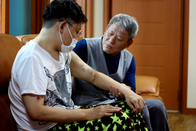 정기창(60) 씨가 외아들 민우(33) 씨의 팔을 어루만지고 있다. 주 3회 받는 신장투석으로 민우씨의 팔에는 투석관이 남긴 상처가 여기저기 퍼져있다. 이주형 기자.