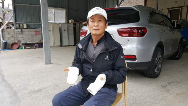 29일 경북 청도군 매전면 관하2리 김기동 이장이 이웃 주민이 아궁이에 불을 지피다 옷에 불이 붙은 긴박한 상황을 목격하고 달려가 큰 화를 면하게 하고, 자신도 양손에 화상을 입은 손을 들어 보이고 있다. 노진규 기자