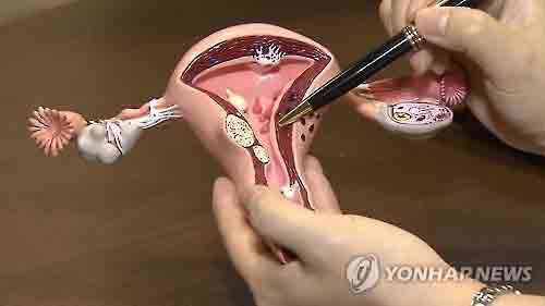 권상훈 계명대 동산병원 산부인과 교수
