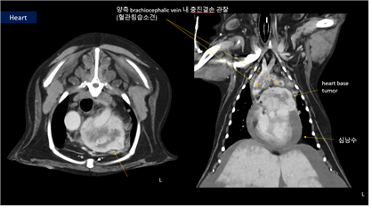 테리의 흉부 CT 이미지, 심장에 형성된 종양(노란화살표)은 확연히 커져 있었으며 중요 혈관으로 종양이 침습되는 상황이었다. 돌발적인 심정지가 언제라도 발생할 수 있는 매우 심각한 상태였다. 탑스동물메디컬센터 제공.