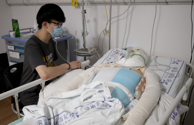 정재환(가명·20) 씨가 온몸에 화상을 입고 병실에 누워있는 엄마 김혜영(가명·49) 씨를 간호하고 있다. 김영진 기자 kyjmaeil@imaeil.com